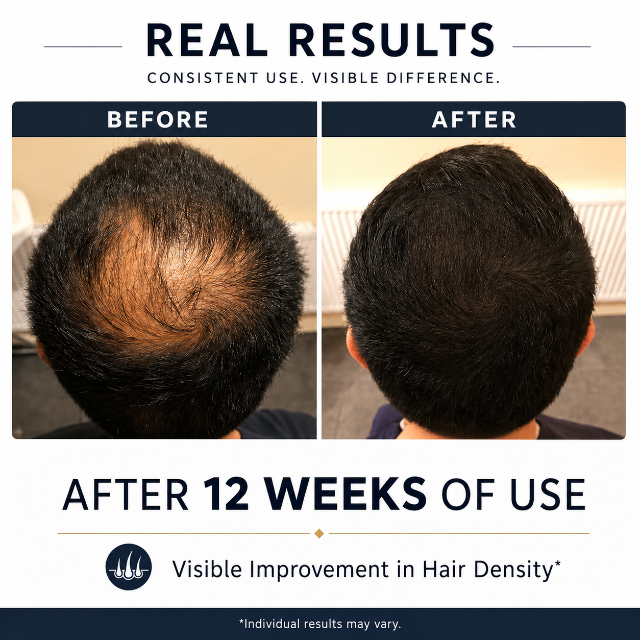 Soraderma Hair Growth Serum