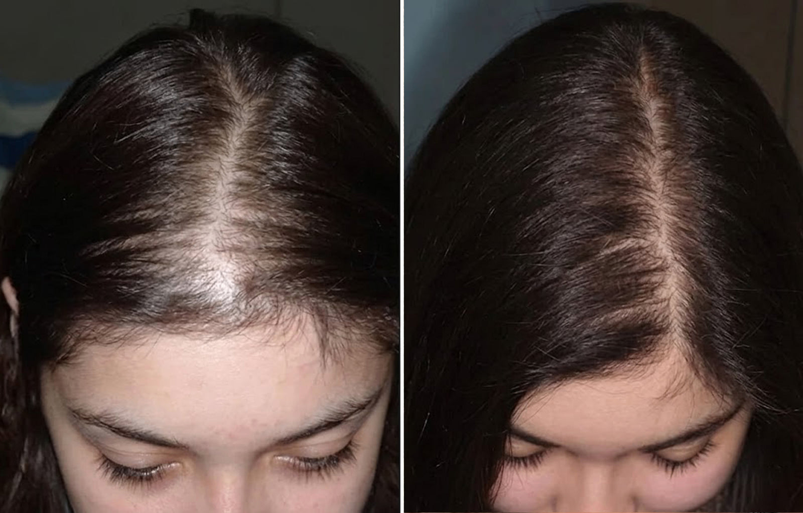 Before and after hair appearance for Emma, 28